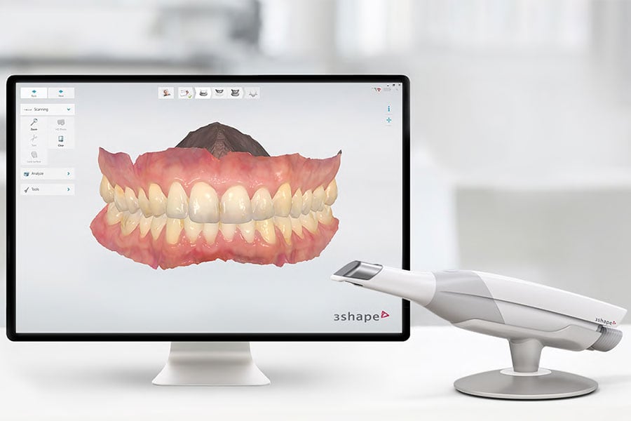 Introducing the Trios 3D Dental Imaging System - Blodgett Dental Care